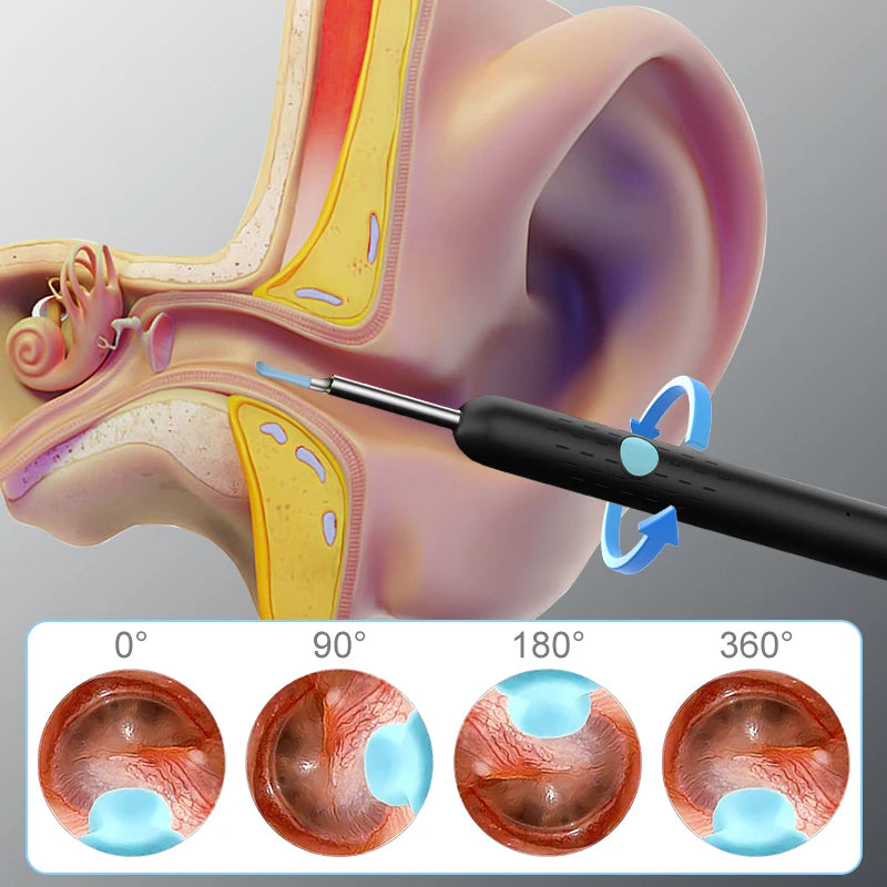 Ear Wax Cleaning Bundle